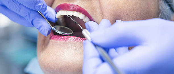 Teeth Whitening in NY